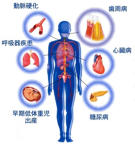 歯周病の影響