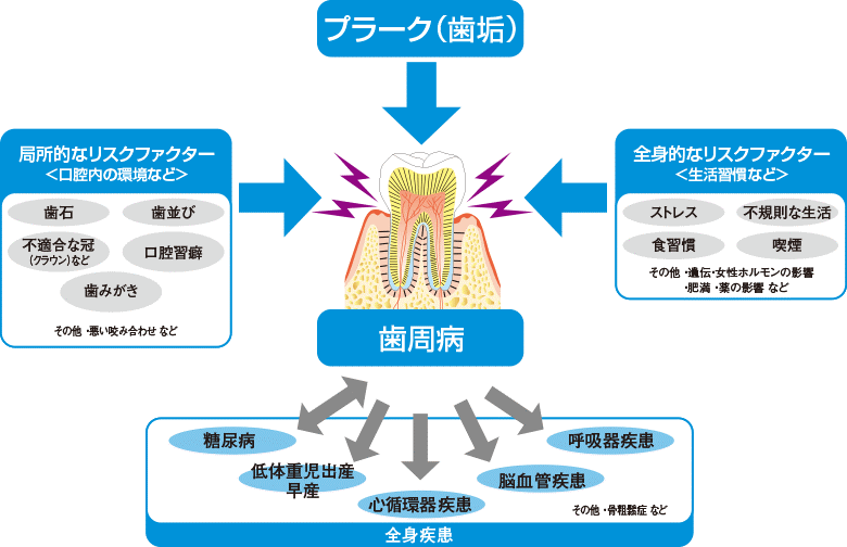 歯周病の危険因子