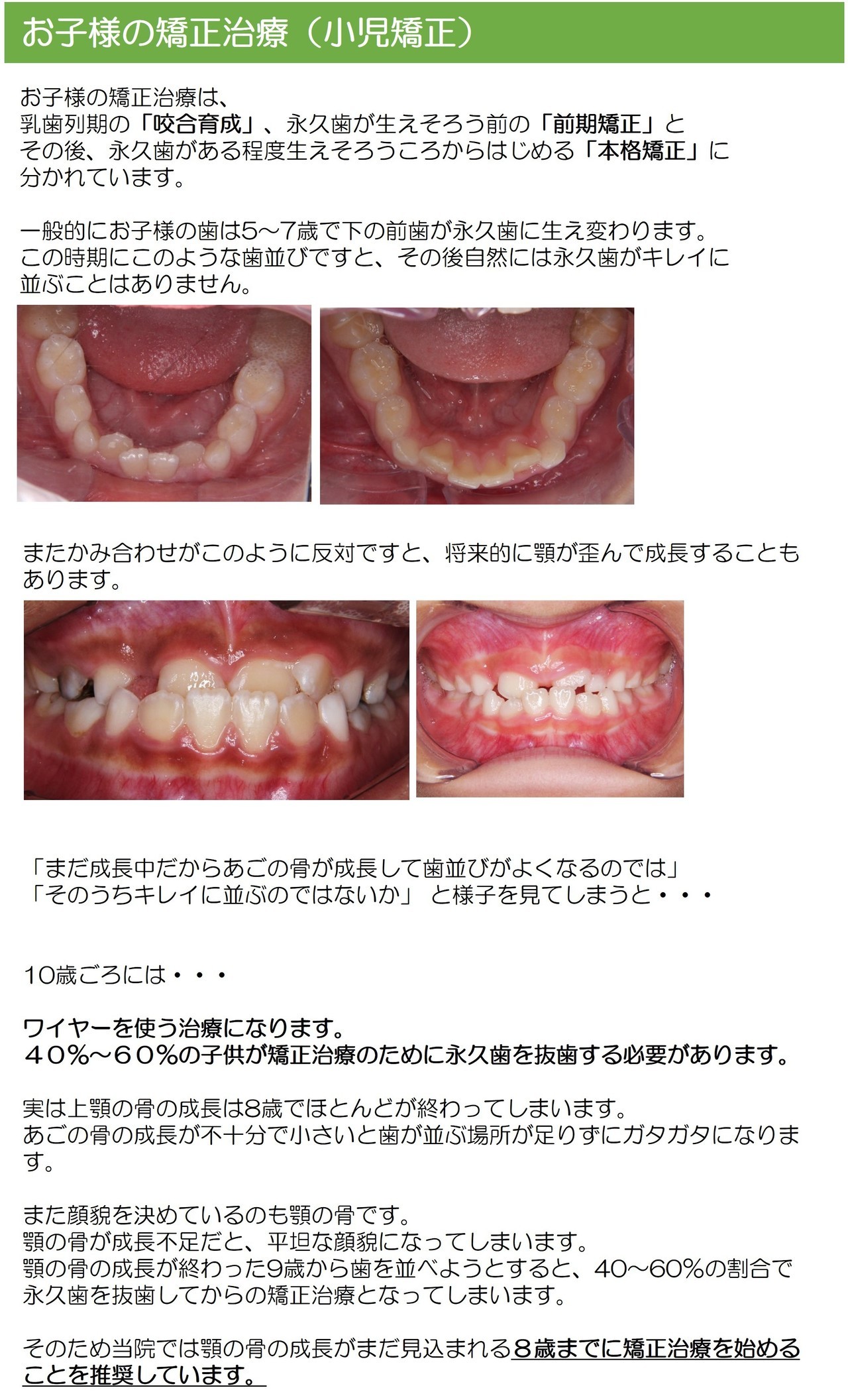 お子様の矯正治療