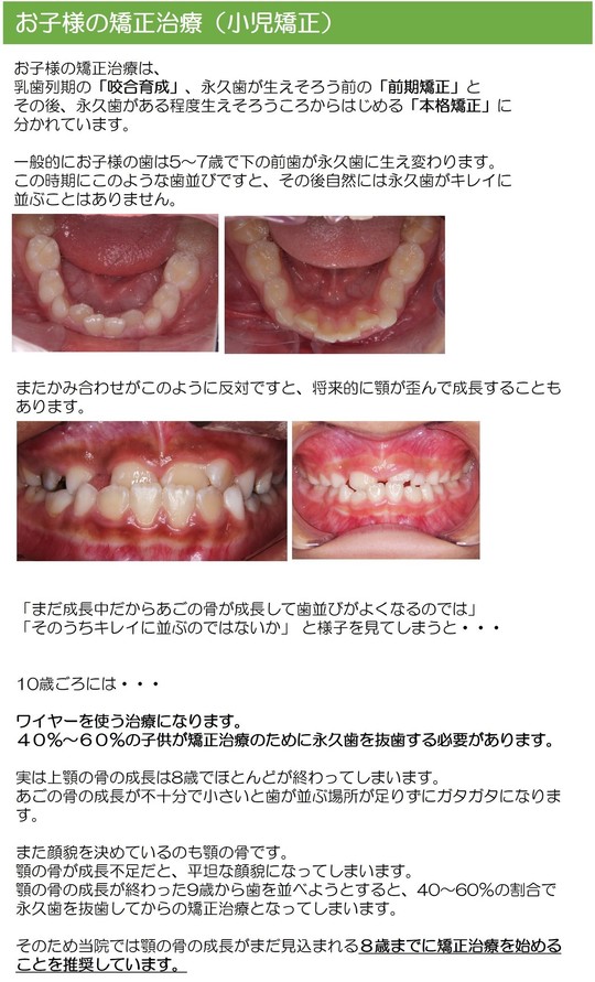 小児矯正治療（床矯正） - 【公式】もりなデンタルクリニック