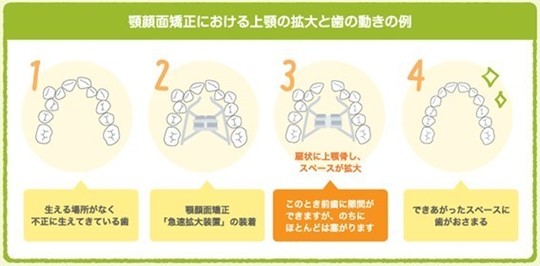 顎顔面矯正 - 【公式】もりなデンタルクリニック【ネット予約可